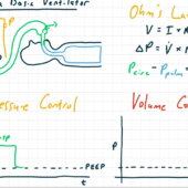 The Basic Ventilator