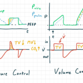 PC & VC: Clinical Considerations